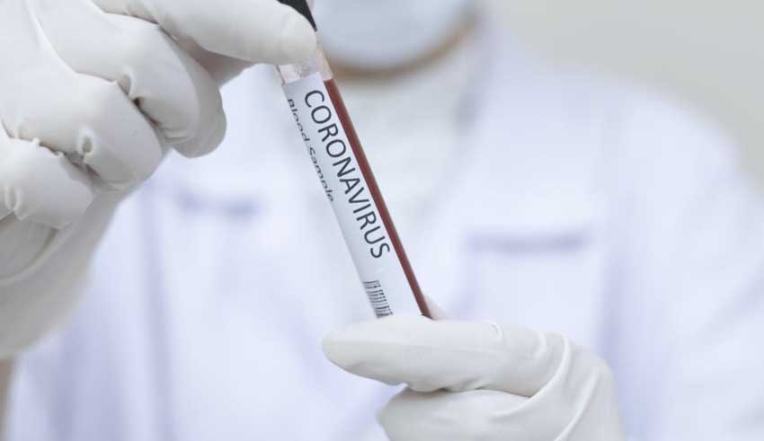 Coronavirus – 200 mille kits de dépistage rapide disponibles en Tunisie: Le dépistage massif changera-t-il la donne ?