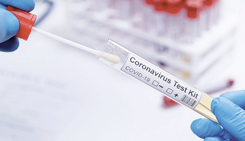 Polémique autour des tests de diagnostic du coronavirus EM3 : Les Tunisiens sont-ils doublement sanctionnés ?