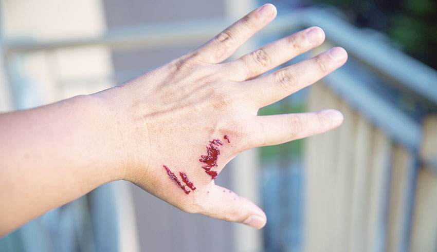 La Tunisie adopte un plan national de lutte contre la rage