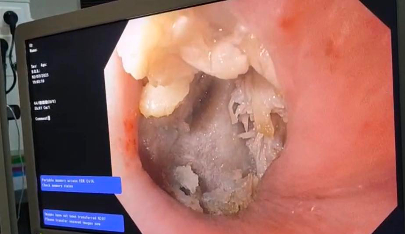 Elle suffoquait : Lamia Kallel raconte trois heures de combat pour sauver une vie à l’hôpital public