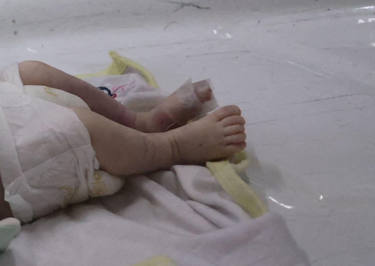 Une nourrisson palestinienne meurt de faim à Gaza