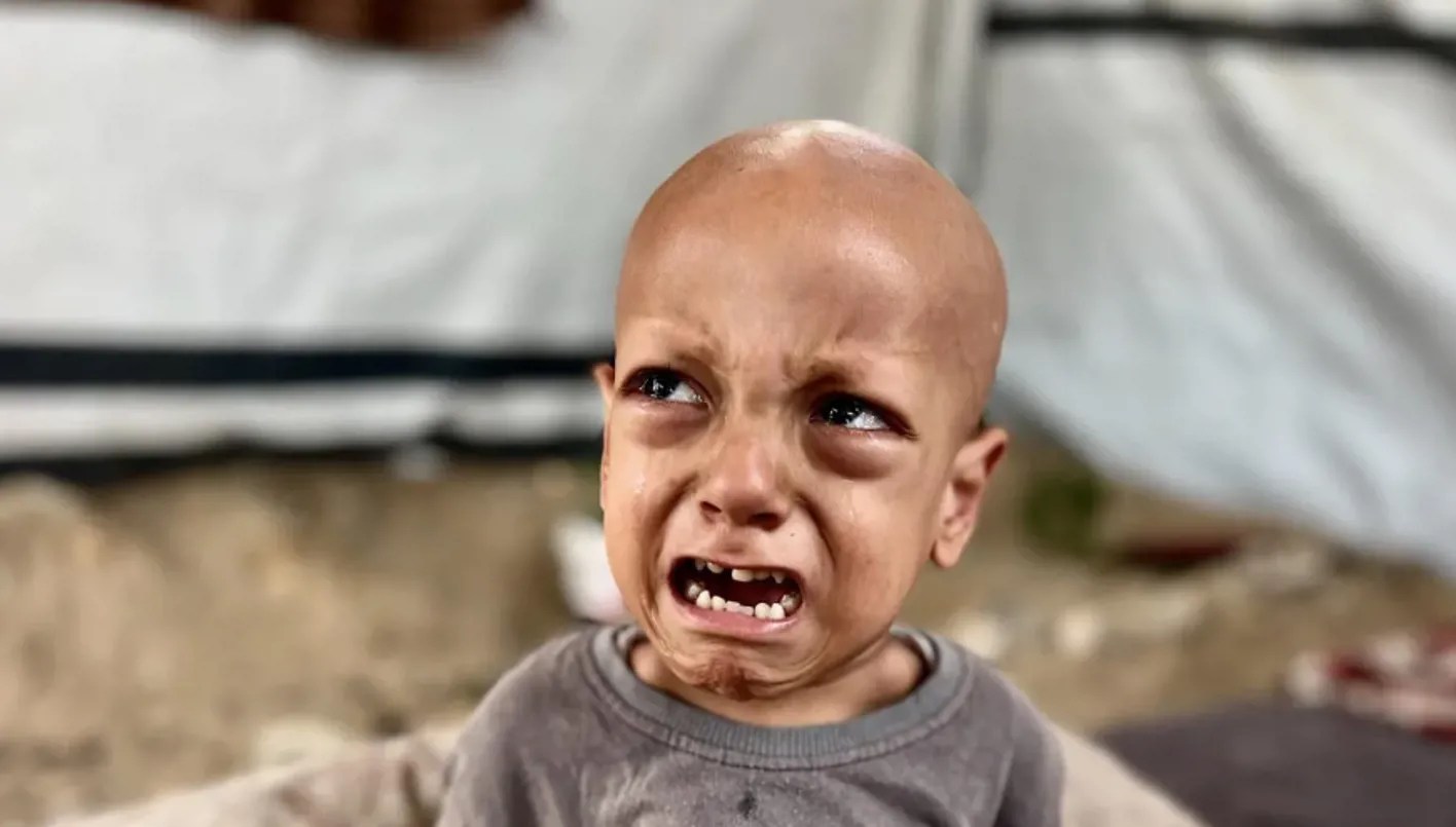 La faim tue Abdallah, jeune Palestinien oublié du monde