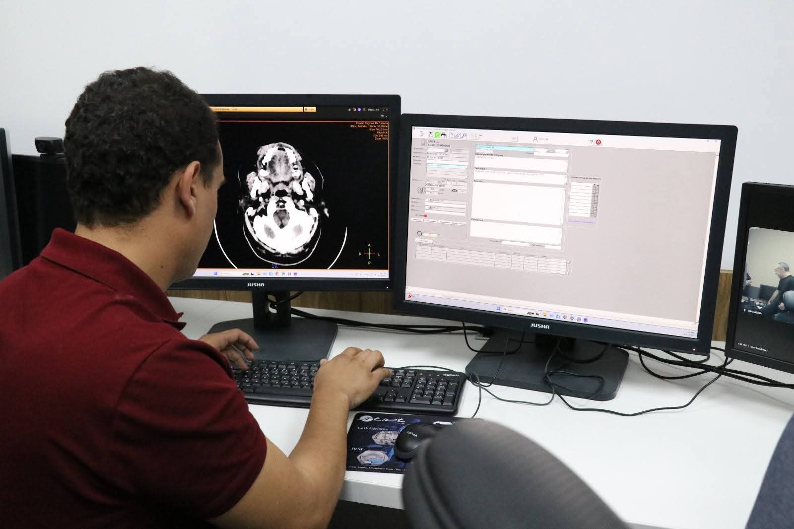 Tunisie : Lancement expérimental du centre médical à distance