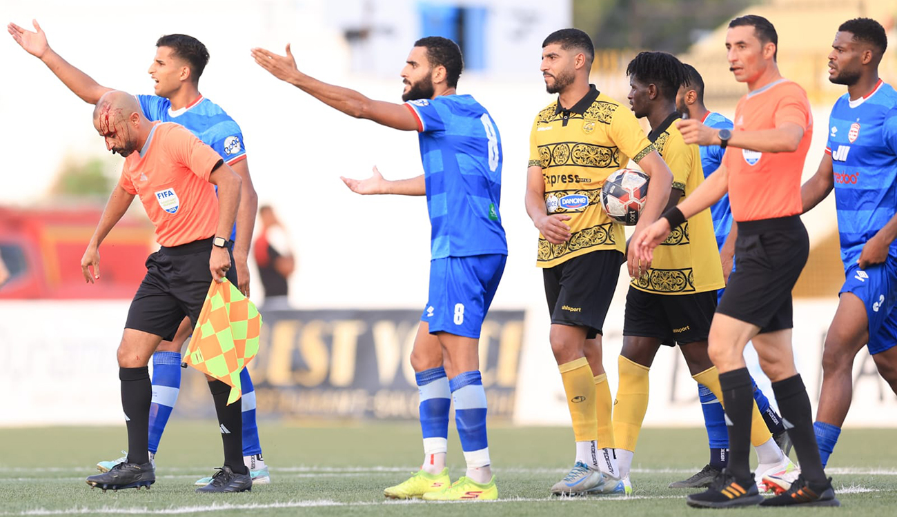 Ligue 1 – La violence a encore frappé : Des proportions graves !