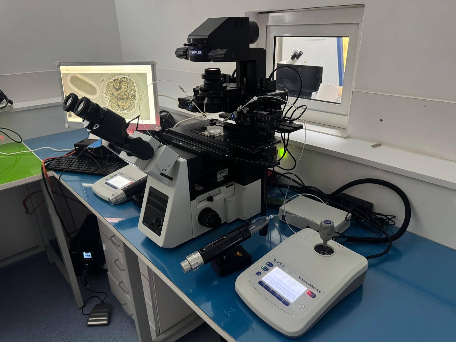 Santé : les centres de fertilité publics dotés de technologies...