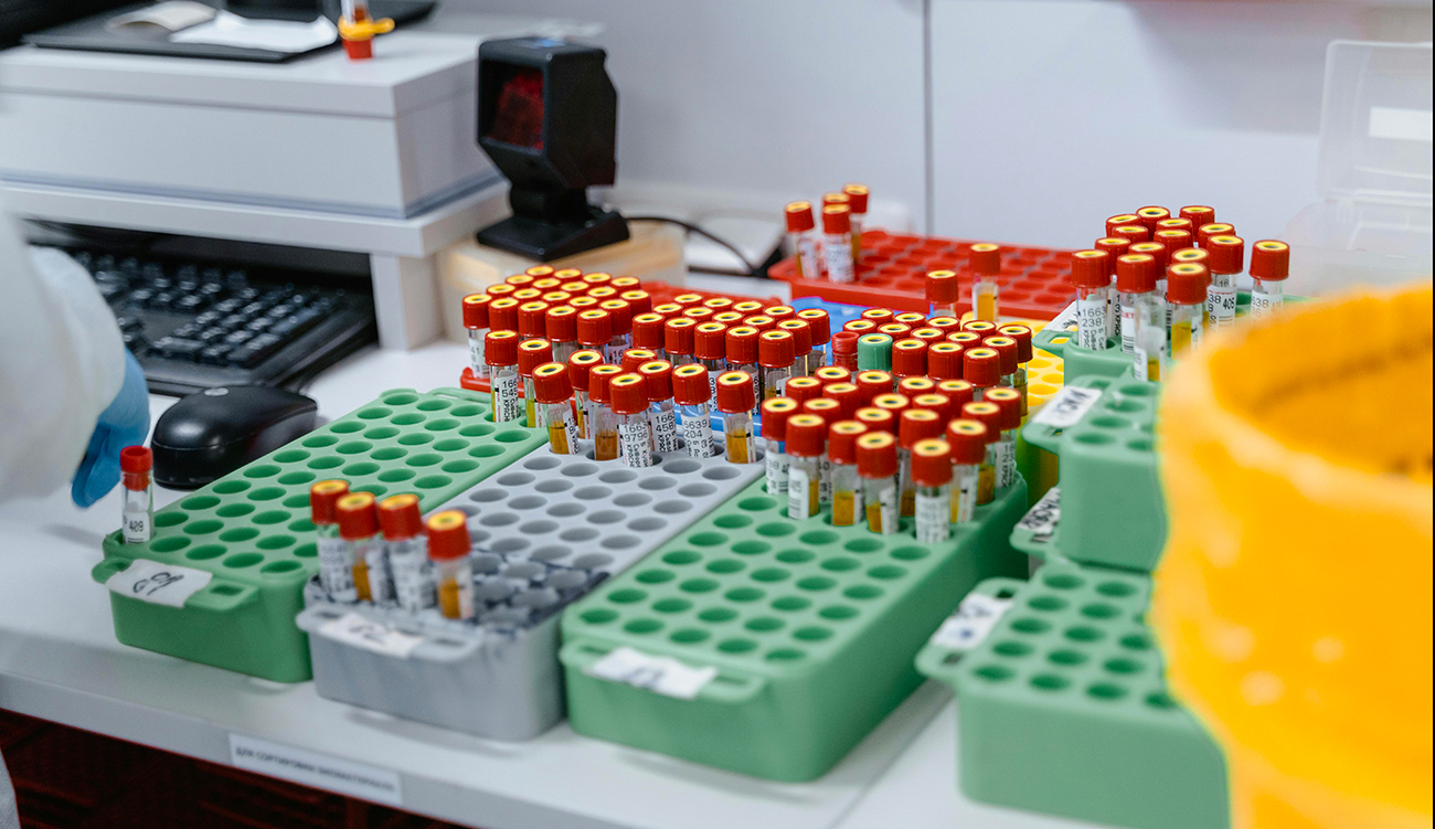 Le syndicat des biologistes Privés appelle la CNAM à payer...