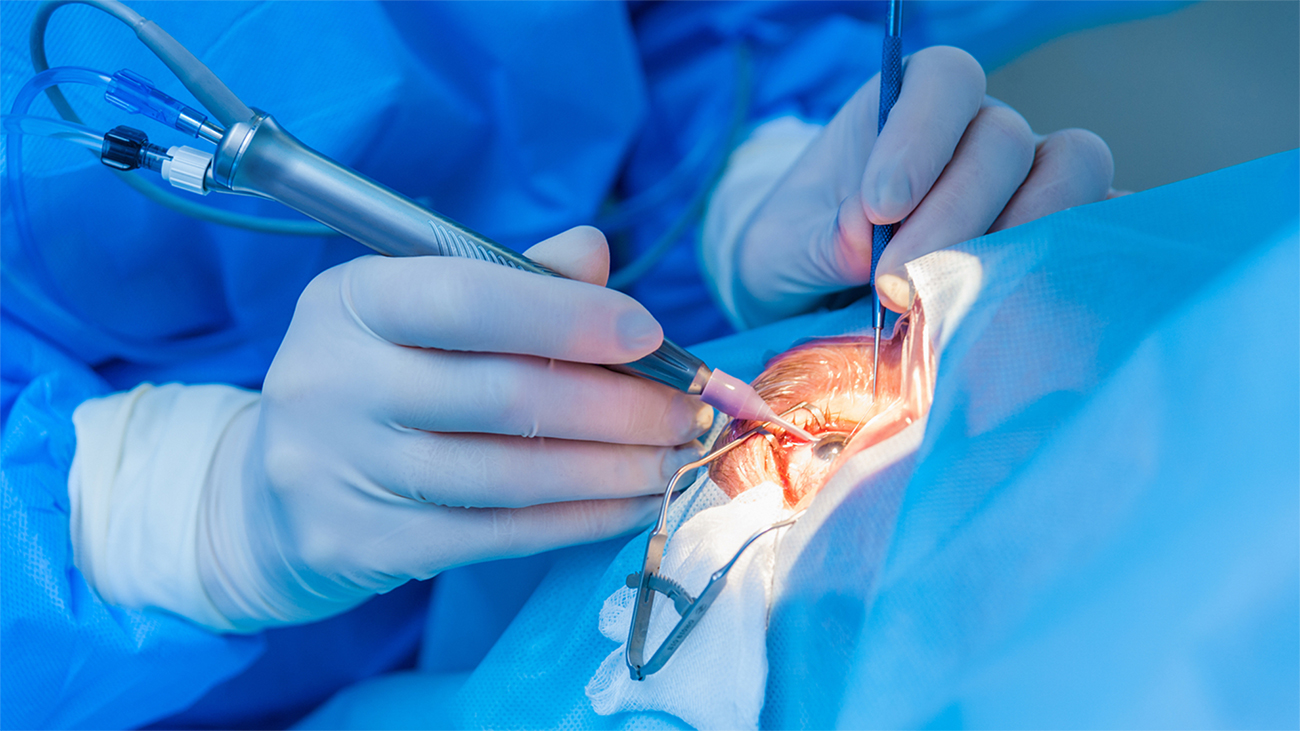 Kasserine : 31 opérations de la cataracte gratuites pour les...