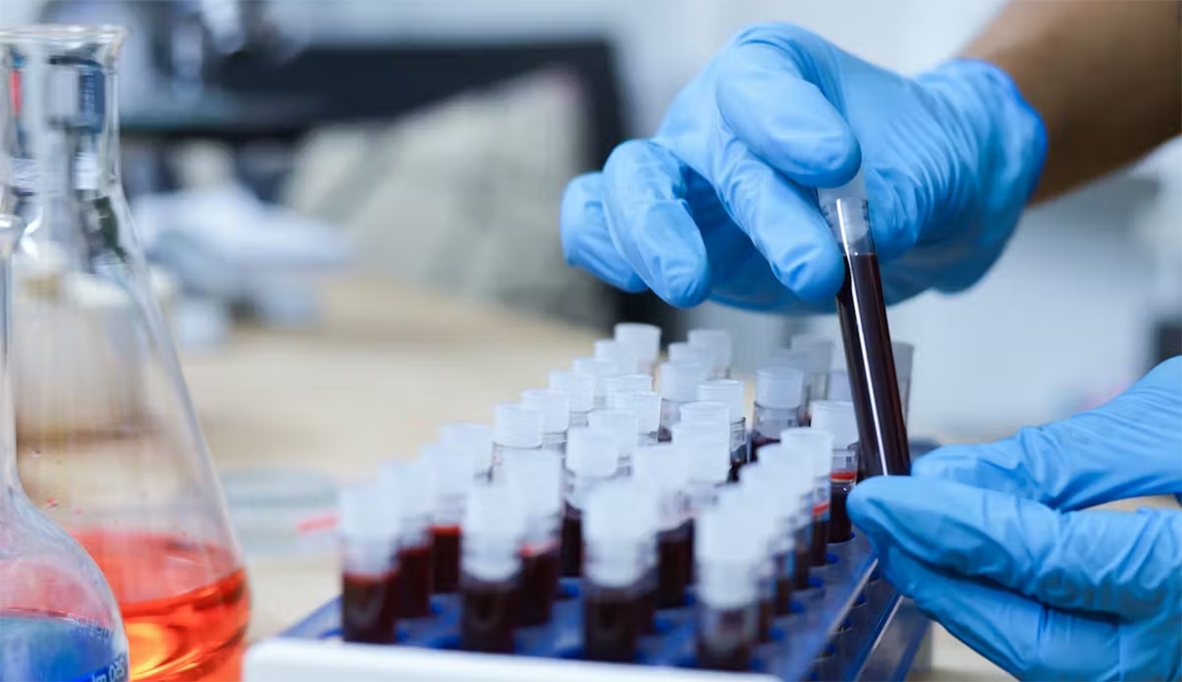 Santé : des dépistages gratuits et accessibles pour trois cancers...