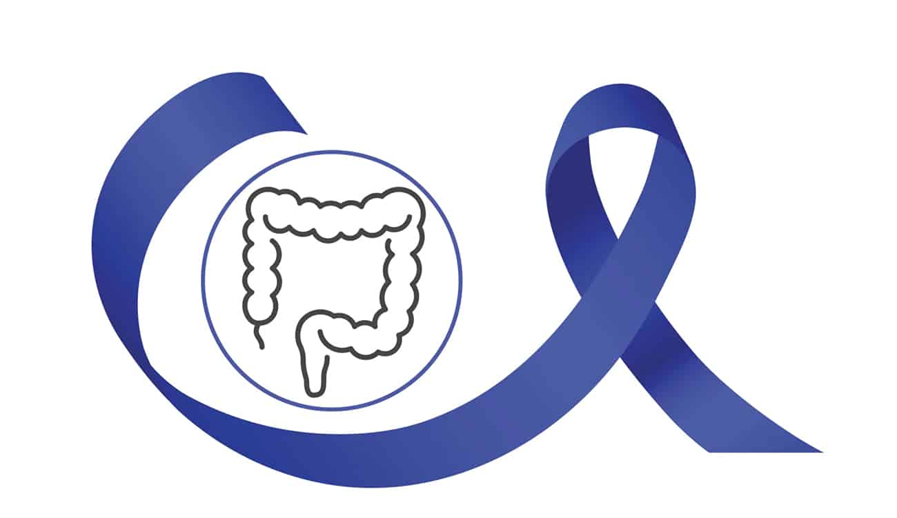 Cancer colorectal : le dépistage précoce des polypes recommandé dès...