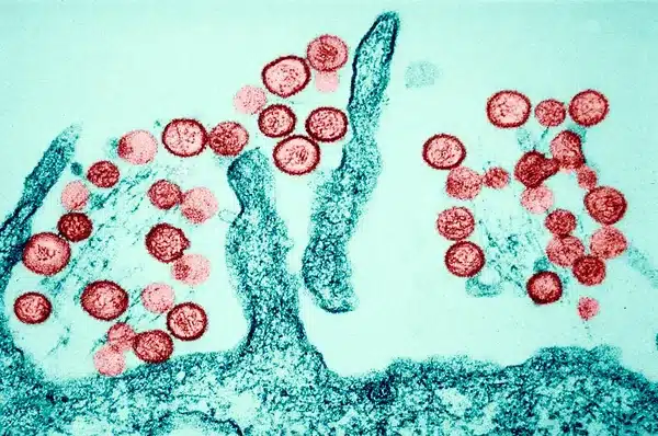 Virus Hanta : ce que dit l’OMS après des décès...