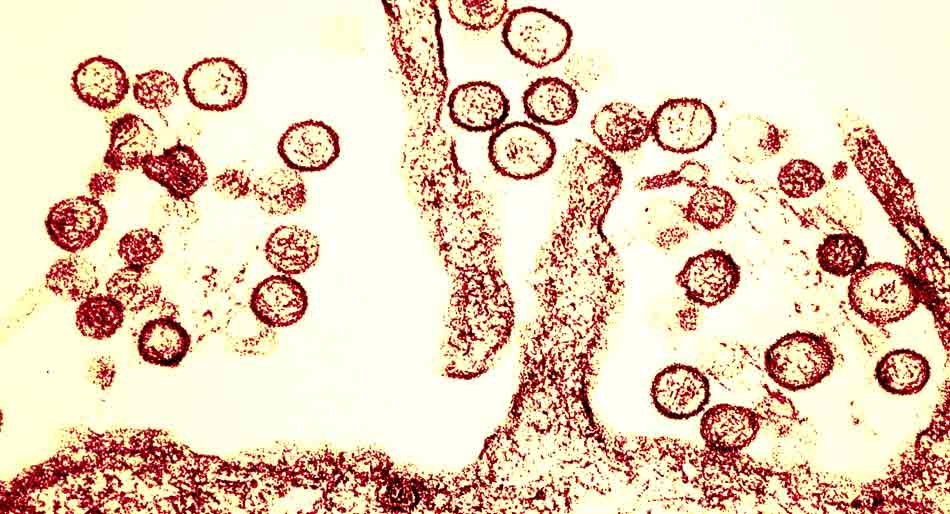 Suspicion d’hantavirus : un avion sanitaire bloqué aux Canaries après...